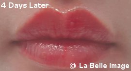 Lip Coloring4days later