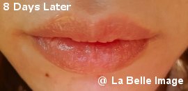 Lip Coloring 8days later