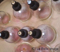 Cupping detox image