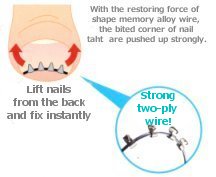 Both ends of the nail stretched