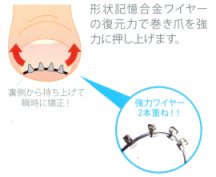 爪の両端が広がる